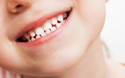 Importancia del cuidado de los dientes de leche